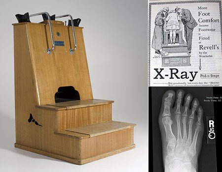 рентген для примерки обуви